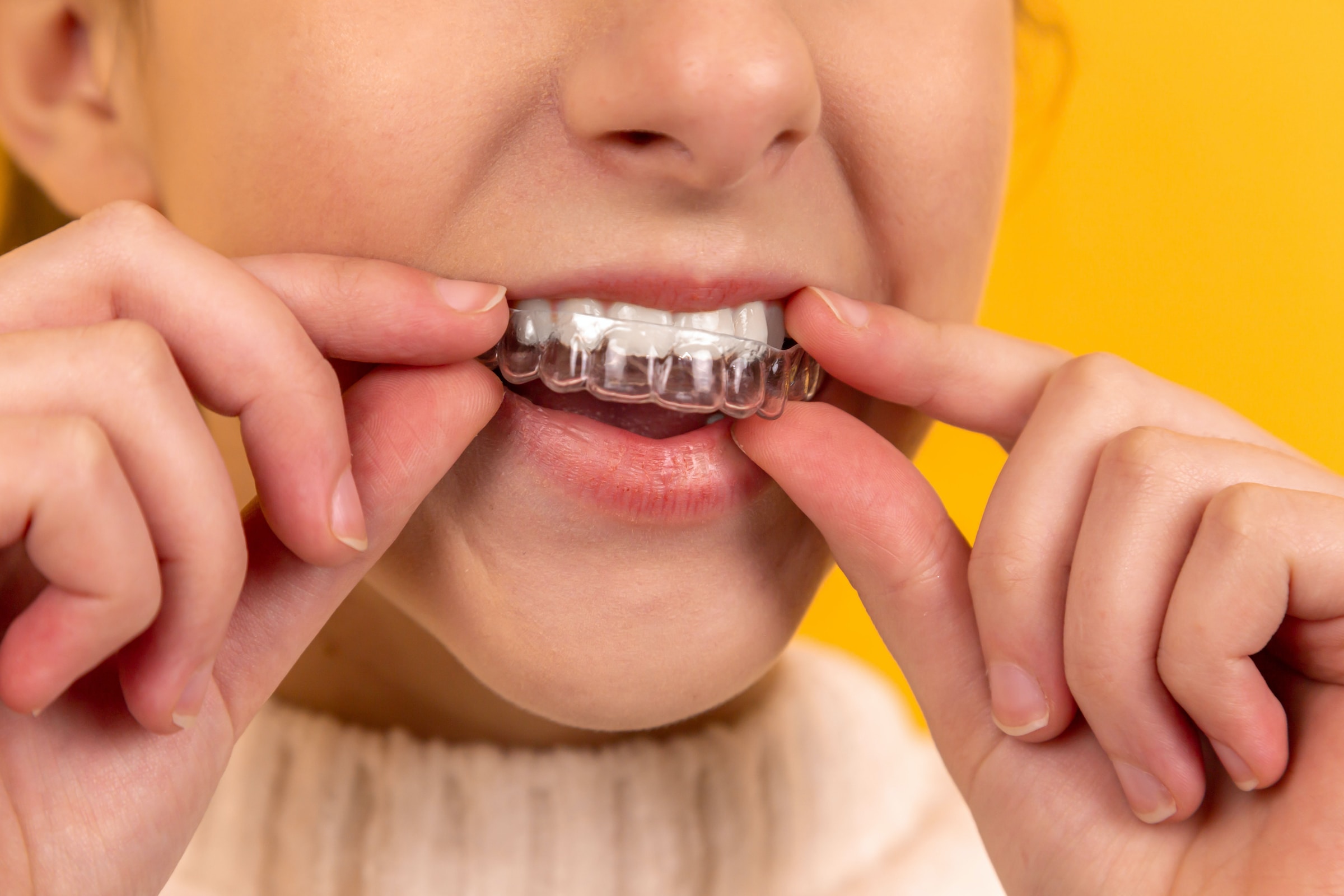 Woman putting in retainer